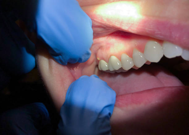 Best Emergency Cosmetic Dentistry in University Of Virginia, VA