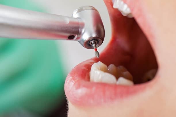 Best Broken or Cracked Tooth Emergency Dentist in University Of Virginia, VA
